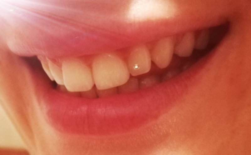 Swarowski fogékszer: csillogóbb mosoly